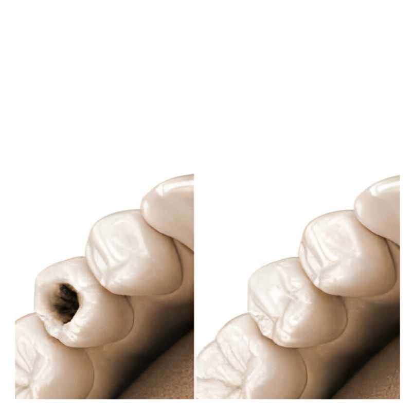 Image for Service: Fillings